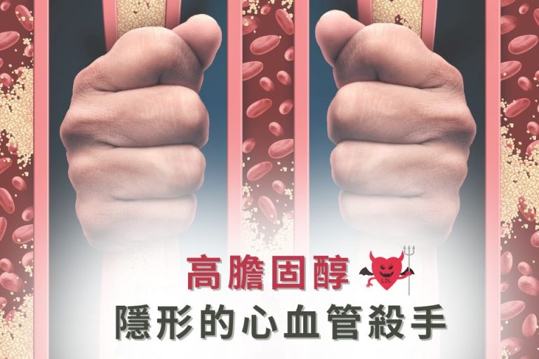 高膽固醇隱藏心血管危險,強烈影響健康,需及早預防與治療。