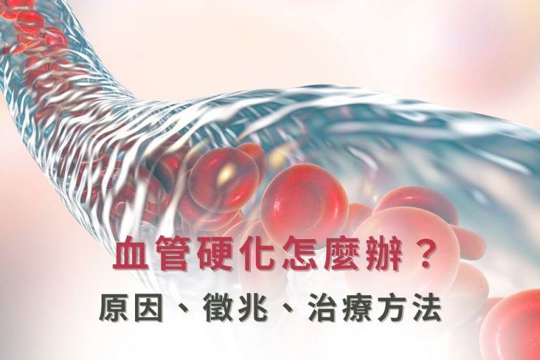 血管硬化處理,揭示原因與治療方法,強化血管健康。