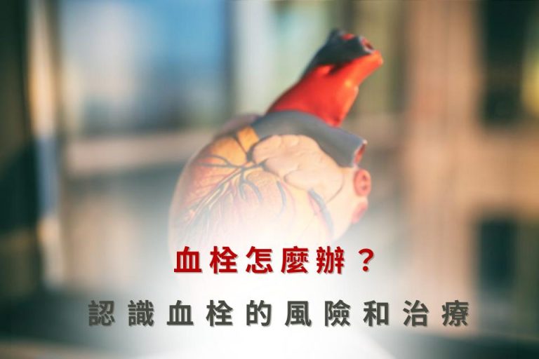 血管怎麼辦?認識血管的風險和治療。